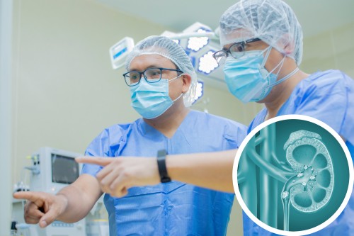 Cirugía de Cálculos Renales